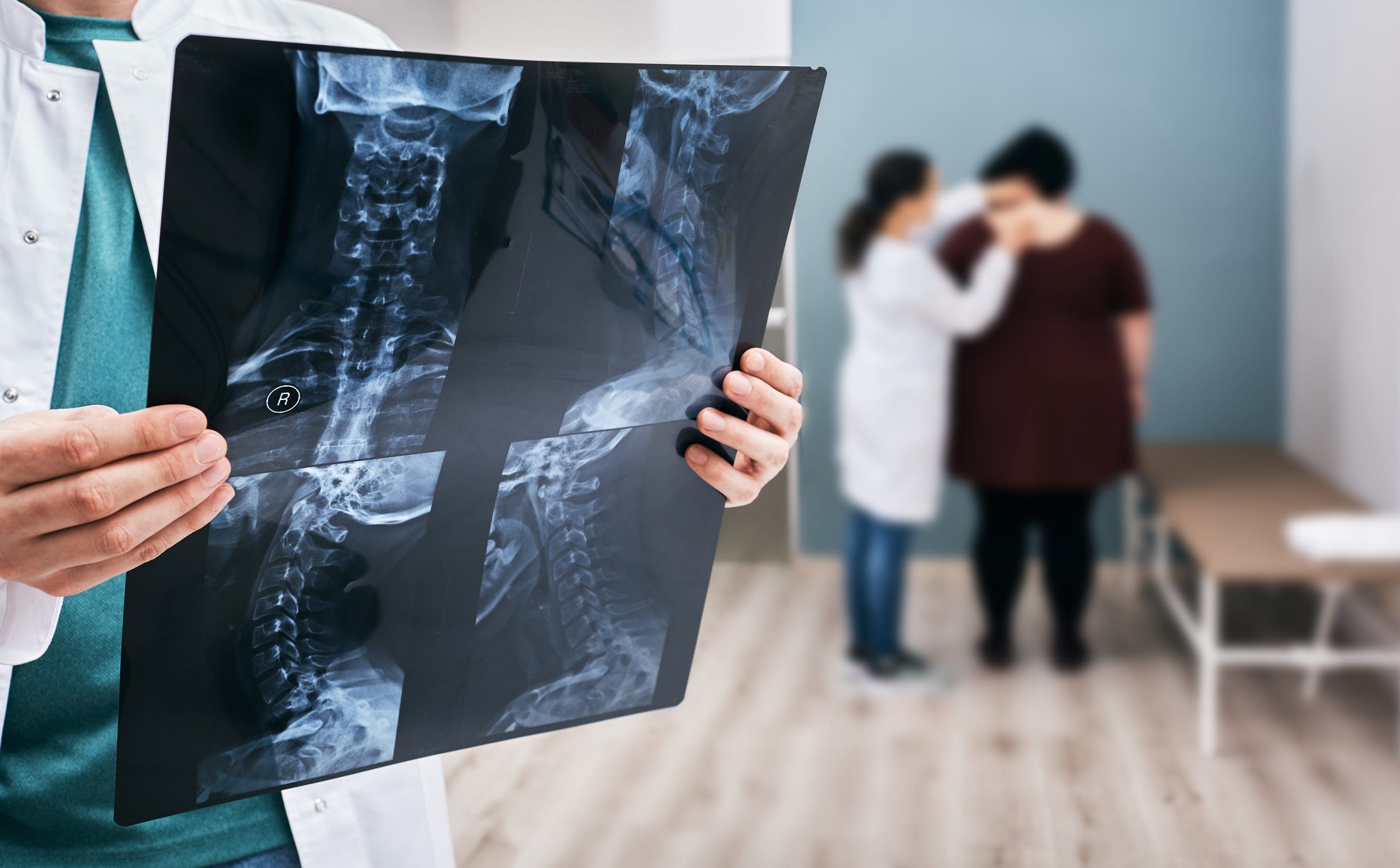 Doctor holds an x-ray of a cervical spine over background osteopath check-up overweight woman's spine. Scoliosis of spine, diagnosis Murfreesboro Chiropractic Xray