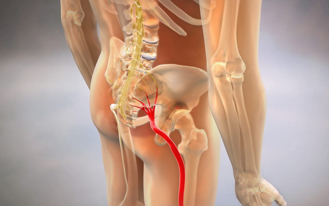 Understanding Sciatica: How Chiropractic Care Can Offer Relief